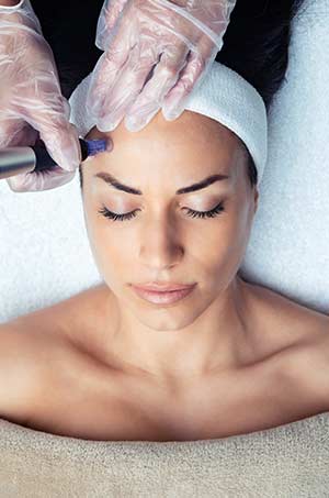 Microneedling Treatment Specialist Near Me in Canton, MI