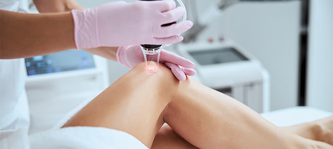 Laser Leg Veins Treatment Specialist Near Me in Canton, MI 