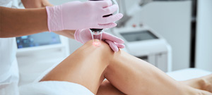 Laser Leg Veins Treatment Specialist Near Me in Canton, MI Laser Leg Veins Treatment Specialist Near Me in Canton, MI