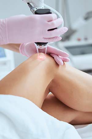 Leg Veins Treatment Near Me in Canton, MI