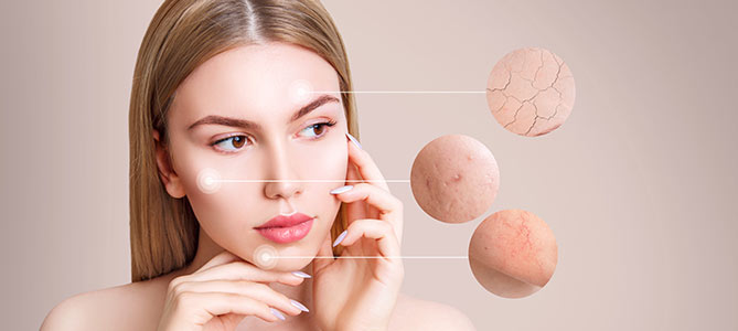 Acne Treatment Specialist Near Me in Canton MI