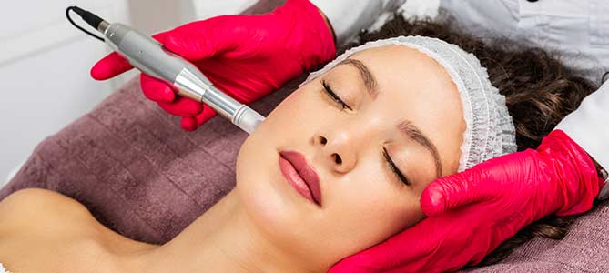 Who is a Good Candidate for Microneedling in Canton MI