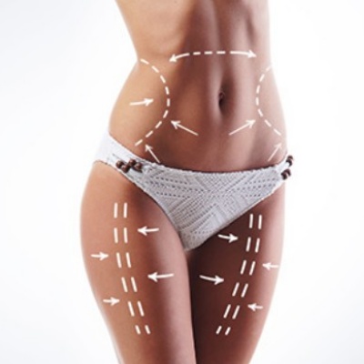 Body Contouring Treatment Specialist Near Me in Canton, MI