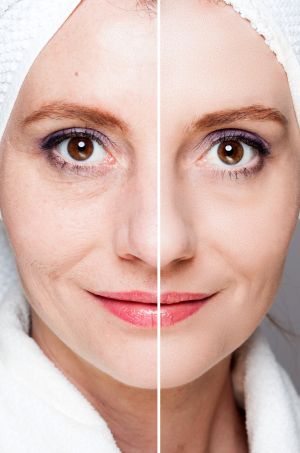 Before and After by Prime Skin & Laser Med Spa in Canton, MI