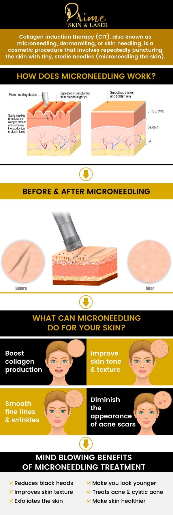 Microneedling treatment at Prime Skin & Laser Med Spa provides many encouraging benefits including scar treatment, anti-aging treatments, general skin health, and so much more. Contact us today for more information or schedule an appointment online. We are conveniently located at 5748 N Canton Center Rd, Canton, MI 48187.