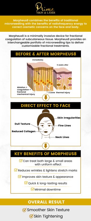 Morpheus8 is a safe, effective, and non-surgical treatment for skin tightening. It tightens saggy pockets of skin, reduces fine lines and wrinkles, and improves the appearance of scarring. Morpheus8 can also be used for the treatment of hyperhidrosis. You can make your skin look younger with this easy, non-invasive procedure offered at Prime Skin & Laser Med Spa. Contact us today or schedule an appointment online! We are conveniently located at 5748 N Canton Center Rd, Canton, MI 48187.