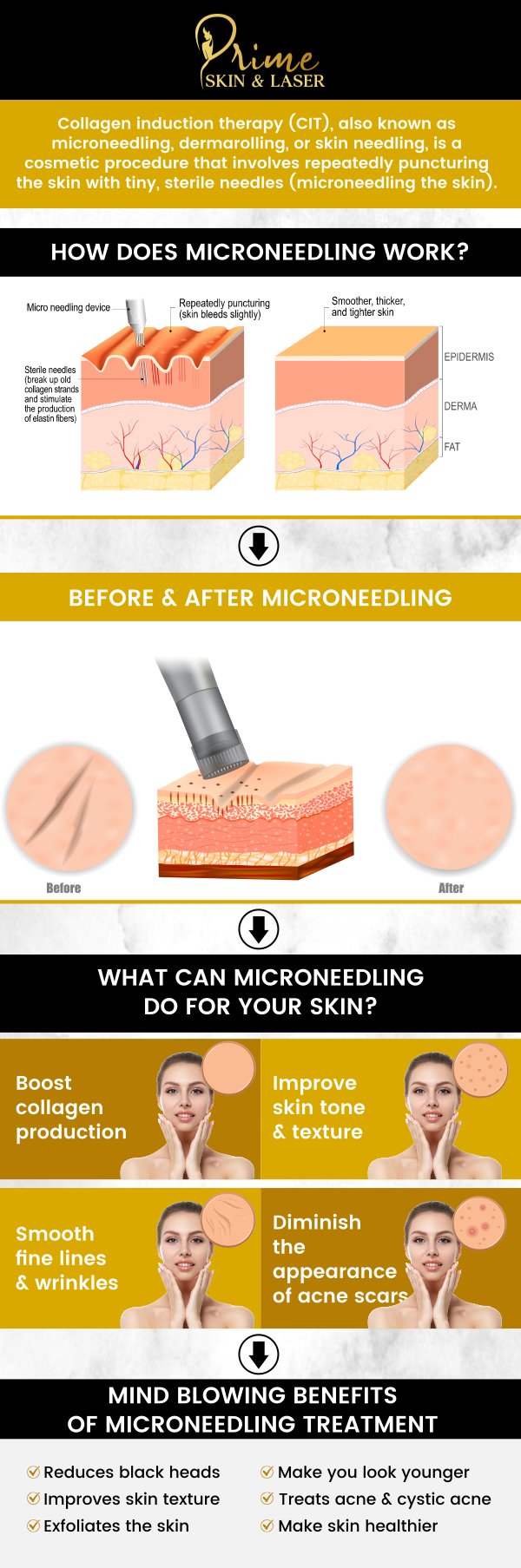 Microneedling is an effective, minimally invasive treatment designed to rejuvenate and refresh your skin by stimulating collagen production. At Prime Skin & Laser, our professional team specializes in microneedling treatments to help improve skin texture, reduce fine lines, and address acne scars. We provide customized care to ensure optimal results, all while maintaining the highest standards of safety and comfort. Contact us today for more information or schedule an appointment online. We are conveniently located at 5748 N Canton Center Rd, Canton Township, MI 48187.