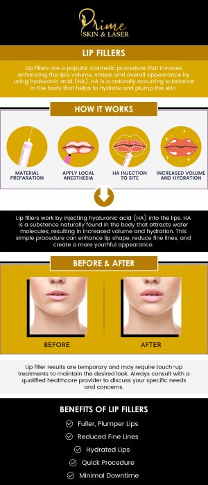 If you're looking for a professional and safe place for lip fillers in Canton, MI, Prime Skin and Laser Med Spa offers services to enhance your natural beauty. Our experienced team uses high-quality dermal fillers to add volume, smooth wrinkles, and create fuller, youthful lips. Whether you're seeking subtle enhancement or a more dramatic change, we provide personalized treatments tailored to your specific needs. Contact us today for more information or schedule an appointment online. We are conveniently located at 5748 North Canton Center Road, Canton, MI 48187.