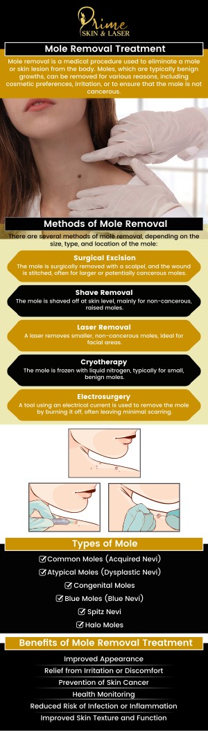 At Prime Skin & Laser Med Spa, our team provides safe and effective laser mole removal treatments designed to enhance your skin’s natural beauty. Using advanced laser technology, we precisely target unwanted moles with minimal discomfort and downtime. Our skilled professionals ensure personalized care tailored to your skin type and aesthetic goals. Trust our team at Prime Skin & Laser Med Spa to help you achieve smooth, clear, and healthy-looking skin. For more information, contact us or schedule an appointment online. We are conveniently located at 5748 N Canton Center Rd, Canton Township, MI 48187. At Prime Skin & Laser Med Spa, our team provides safe and effective laser mole removal treatments designed to enhance your skin’s natural beauty. Using advanced laser technology, we precisely target unwanted moles with minimal discomfort and downtime. Our skilled professionals ensure personalized care tailored to your skin type and aesthetic goals. Trust our team at Prime Skin & Laser Med Spa to help you achieve smooth, clear, and healthy-looking skin. For more information, contact us or schedule an appointment online. We are conveniently located at 5748 N Canton Center Rd, Canton Township, MI 48187.