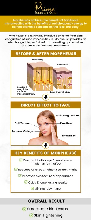 At Prime Skin & Laser Med Spa in Canton, MI, the cost of Morpheus8 treatment generally ranges between $600 and $1,500 per session, depending on your skin type and treatment area. This innovative radiofrequency microneedling procedure tightens skin, smooths texture, and reduces fine lines with minimal downtime. The total cost may vary based on the number of sessions needed to achieve your desired results. Contact us today for more information or schedule an appointment online. We are conveniently located at 5748 N Canton Center Rd, Canton Township, MI 48187. At Prime Skin & Laser Med Spa in Canton, MI, the cost of Morpheus8 treatment generally ranges between $600 and $1,500 per session, depending on your skin type and treatment area. This innovative radiofrequency microneedling procedure tightens skin, smooths texture, and reduces fine lines with minimal downtime. The total cost may vary based on the number of sessions needed to achieve your desired results. Contact us today for more information or schedule an appointment online. We are conveniently located at 5748 N Canton Center Rd, Canton Township, MI 48187.