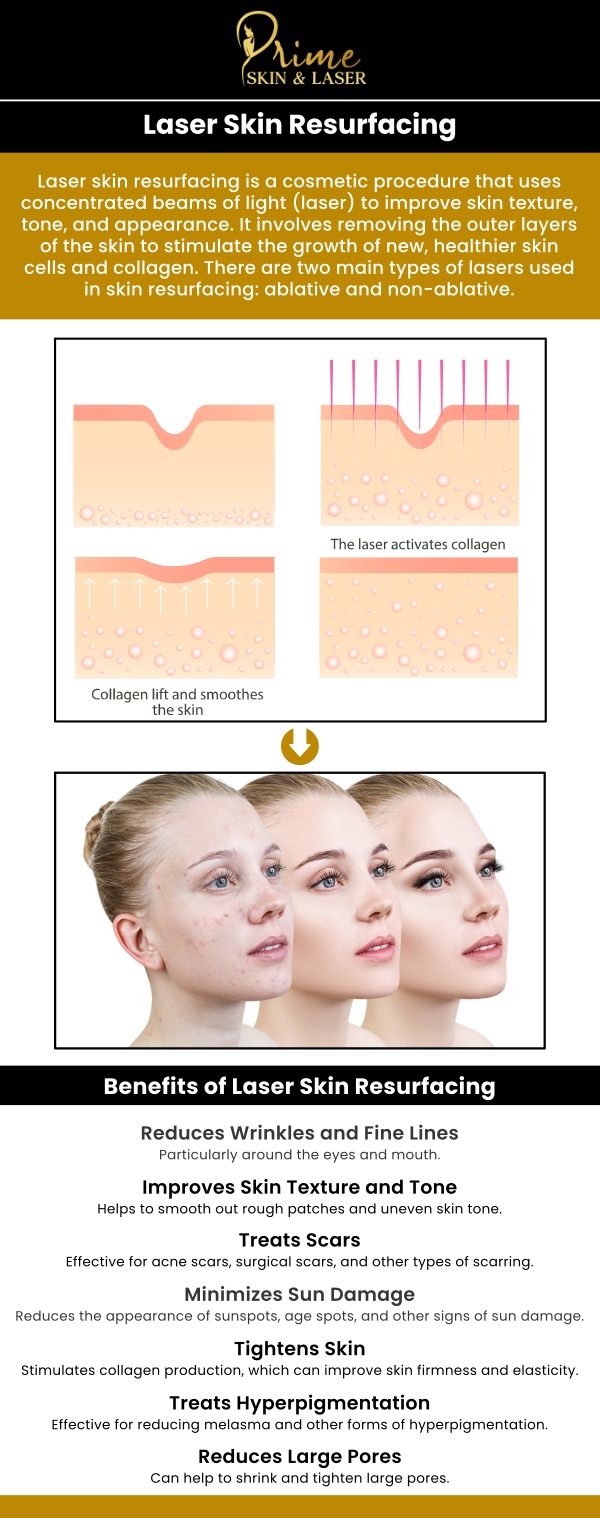 If you're looking for laser skin resurfacing treatments in Canton, MI, Prime Skin & Laser is your trusted destination. We offer advanced CO2 laser treatments designed to rejuvenate your skin and address concerns like wrinkles, scars, and sun damage. Our experienced professionals provide personalized care to ensure optimal results. For more information, contact us or schedule an appointment online. We are conveniently located at 5748 N Canton Center Rd, Canton Township, MI 48187.