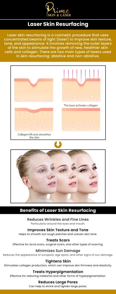 If you're looking for laser skin resurfacing treatments in Canton, MI, Prime Skin & Laser is your trusted destination. We offer advanced CO2 laser treatments designed to rejuvenate your skin and address concerns like wrinkles, scars, and sun damage. Our experienced professionals provide personalized care to ensure optimal results. For more information, contact us or schedule an appointment online. We are conveniently located at 5748 N Canton Center Rd, Canton Township, MI 48187.