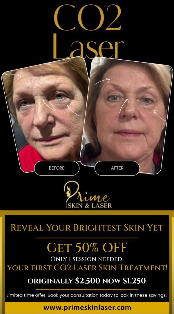 Reveal your brightest skin yet with 50% off your first CO2 laser skin treatment! Achieve glowing, youthful skin with just one session at Prime Skin & Laser Med Spa in Canton, MI. This limited-time offer lets you experience the transformative power of our CO2 laser technology, designed to target and treat signs of aging, sun damage, and skin imperfections. Don't miss out—book your consultation today and lock in these amazing savings!
