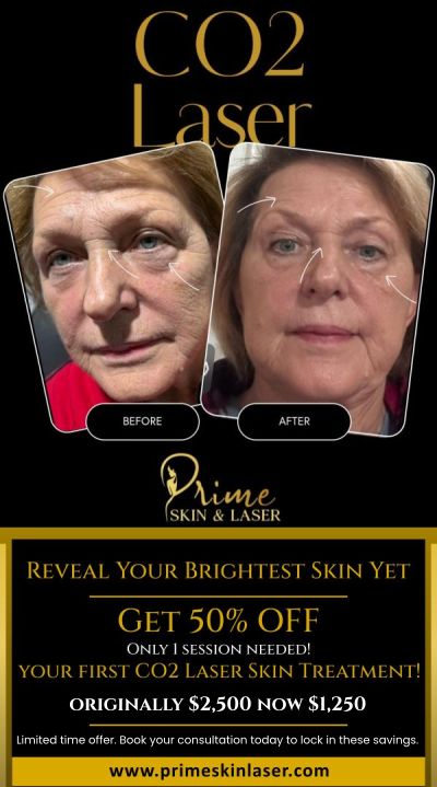 Reveal your brightest skin yet with 50% off your first CO2 laser skin treatment! Achieve glowing, youthful skin with just one session at Prime Skin & Laser Med Spa in Canton, MI. This limited-time offer lets you experience the transformative power of our CO2 laser technology, designed to target and treat signs of aging, sun damage, and skin imperfections. Don't miss out—book your consultation today and lock in these amazing savings!
