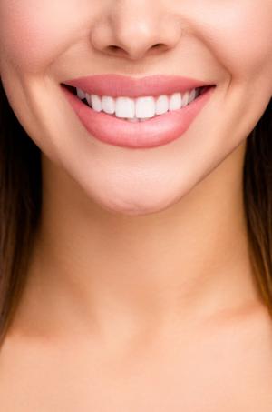 Gummy Smile Specialist in Canton, MI Gummy Smile Specialist in Canton, MI