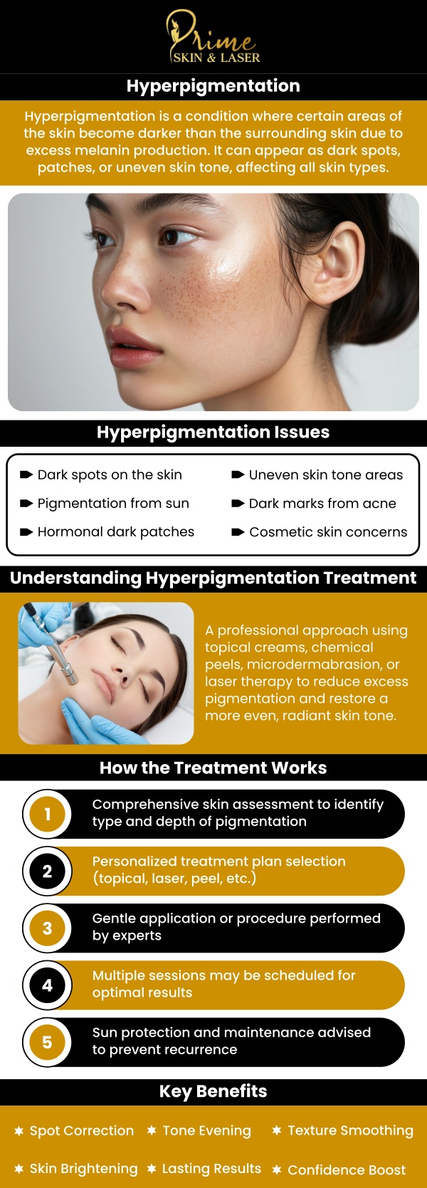 Hyperpigmentation Treatment in Canton, MI Hyperpigmentation Treatment in Canton, MI