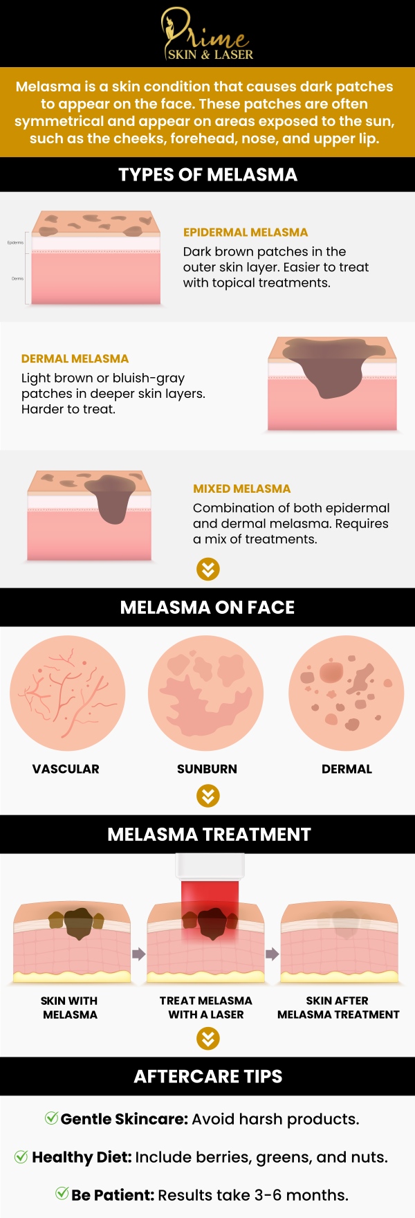 Melasma Treatment in Canton, MI
